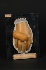 Engelures phlycténoïdes des doigts (Moulage décoloré, Inv. 1922)