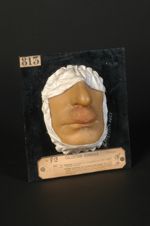 Folliculite sous-nasale non trichophytique (Inv. 1922). Eczéma récidivant de la région sous-nasale.  [...]