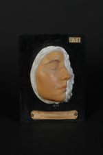 Verrues planes junéviles de la face. Jeune fille âgée de 19 ans