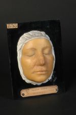 Syphilide tuberculeuse superficielle circinée eczématoïde, de la période tertiaire