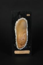 Kératose du talon et impétigo de l'avant-pied et des orteils, chez un sujet sclérodermique (Inv. 192 [...]