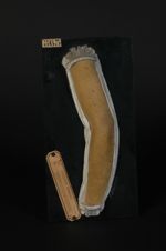 Prurigo de Hebra, chez un jeune sujet (V. le n° 862, cuisse et genou du même malade)