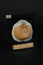 Plaques syphilitiques (Inv. 1922) du menton. Syphilide papulo-squameuse circinée