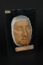 Plaques syphilitiques végétantes, syphilide papuleuse végétante. Homme âgé de 68 ans