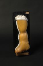 Lésions congénitales multiples : stricture annulaire de la jambe ; syndactylie, amputation des ortei [...]