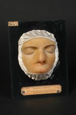 Lupus ulcéreux végétant du nez, au moment de la sortie du malade, avant guérison. Jeune homme âgé de [...]